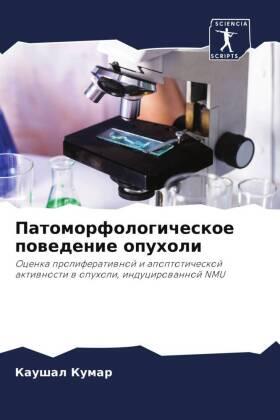 Kumar |  Patomorfologicheskoe powedenie opuholi | Buch |  Sack Fachmedien