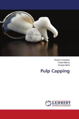 Chandani / Mishra / Nikhil |  Pulp Capping | Buch |  Sack Fachmedien