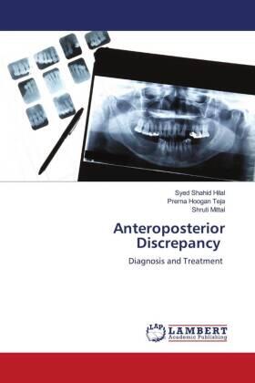 Hilal / Teja / Mittal | Anteroposterior Discrepancy | Buch | 978-620-615017-6 | sack.de