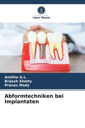 G. L. / Shetty / Mody |  Abformtechniken bei Implantaten | Buch |  Sack Fachmedien