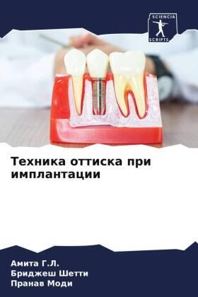 G. L. / Shetti / Modi |  Tehnika ottiska pri implantacii | Buch |  Sack Fachmedien