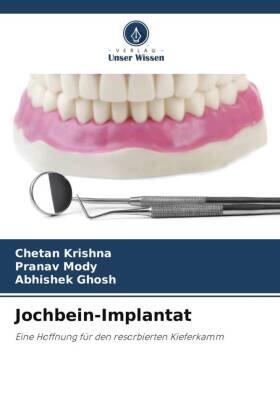 Krishna / Mody / Ghosh |  Jochbein-Implantat | Buch |  Sack Fachmedien