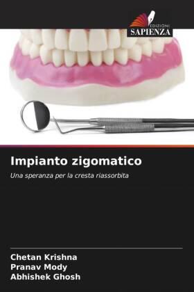 Krishna / Mody / Ghosh |  Impianto zigomatico | Buch |  Sack Fachmedien