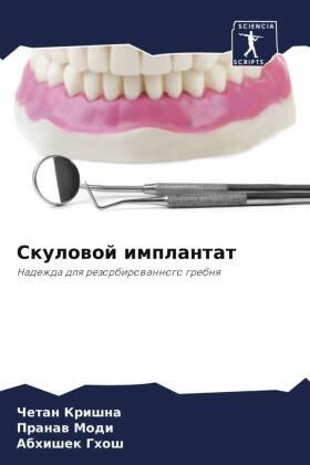 Krishna / Modi / Ghosh |  Skulowoj implantat | Buch |  Sack Fachmedien