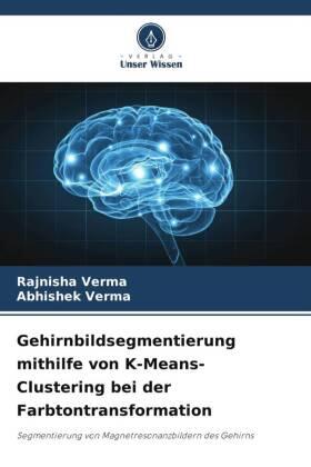 Verma |  Gehirnbildsegmentierung mithilfe von K-Means-Clustering bei der Farbtontransformation | Buch |  Sack Fachmedien