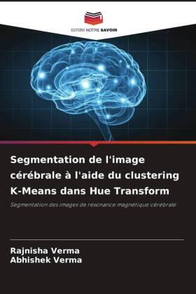 Verma |  Segmentation de l'image cérébrale à l'aide du clustering K-Means dans Hue Transform | Buch |  Sack Fachmedien