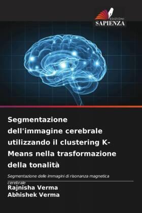 Verma |  Segmentazione dell'immagine cerebrale utilizzando il clustering K-Means nella trasformazione della tonalità | Buch |  Sack Fachmedien