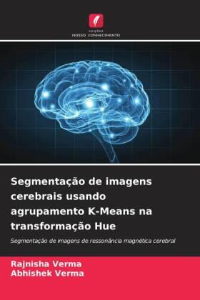 Verma |  Segmentação de imagens cerebrais usando agrupamento K-Means na transformação Hue | Buch |  Sack Fachmedien