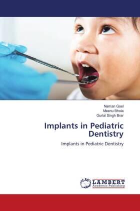 Goel / Bhola / Brar |  Implants in Pediatric Dentistry | Buch |  Sack Fachmedien
