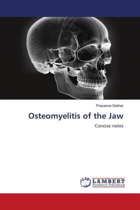 Sekhar |  Osteomyelitis of the Jaw | Buch |  Sack Fachmedien