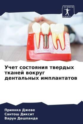 Dzhewe / Dixit / Deshpande |  Uchet sostoqniq twerdyh tkanej wokrug dental'nyh implantatow | Buch |  Sack Fachmedien