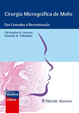 Harmon / Tolkachjov |  Cirurgia Micrográfica de Mohs | eBook | Sack Fachmedien