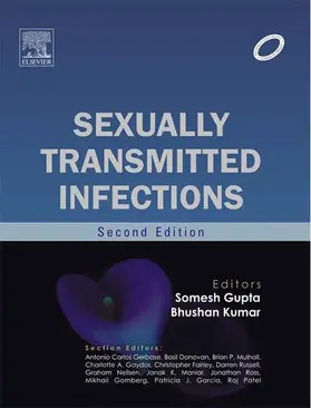 Kumar / Gupta |  Sexually Transmitted Infections - E-book | eBook | Sack Fachmedien