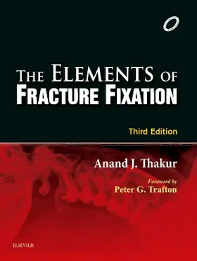 Thakur | Elements of Fracture Fixation | Buch | 978-81-312-4236-0 | sack.de