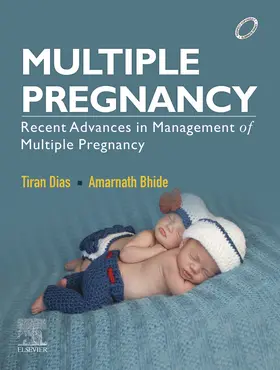 Dias / Bhide MD |  Multiple Pregnancy- E-book | eBook | Sack Fachmedien