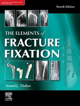Thakur | The elements of fracture fixation, 4e | Buch | 978-81-312-5655-8 | sack.de