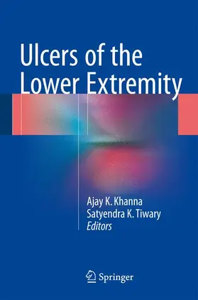 Khanna / Tiwary |  Ulcers of the Lower Extremity | Buch |  Sack Fachmedien