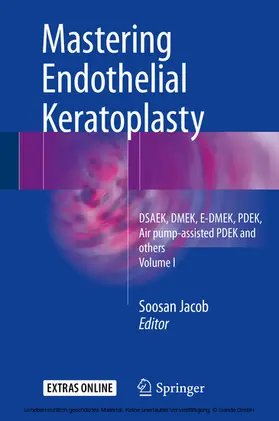 Jacob |  Mastering Endothelial Keratoplasty | eBook | Sack Fachmedien