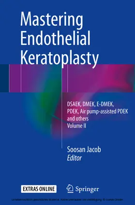 Jacob |  Mastering Endothelial Keratoplasty | eBook | Sack Fachmedien