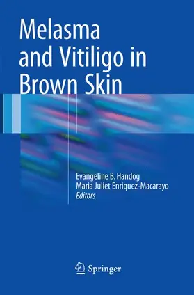 Handog / Enriquez-Macarayo |  Melasma and Vitiligo in Brown Skin | Buch |  Sack Fachmedien