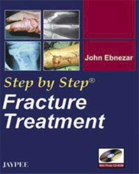 Ebnezar | Step by Step: Fracture Treatment | Medienkombination | 978-81-8448-254-6 | sack.de