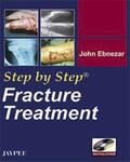 Ebnezar |  Step by Step: Fracture Treatment | Buch |  Sack Fachmedien