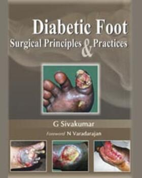 Sivakumar | Diabetic Foot | Buch | 978-81-8448-739-8 | sack.de