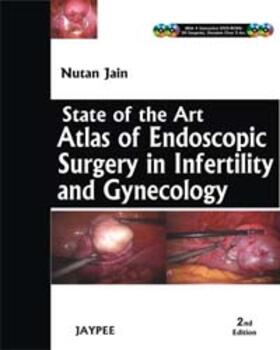 Jain |  State-of-the-Art Atlas of Endoscopic Surgery in Infertility and Gynecology | Buch |  Sack Fachmedien