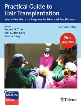 True / Garg |  Practical Guide to Hair Transplantation | eBook | Sack Fachmedien