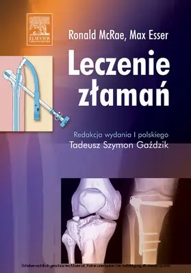 McRae |  Leczenie zlaman | eBook | Sack Fachmedien