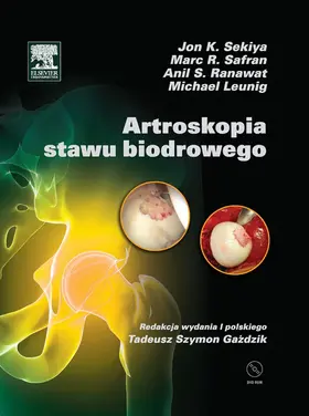 Leunig |  Artroskopia stawu biodrowego | eBook | Sack Fachmedien