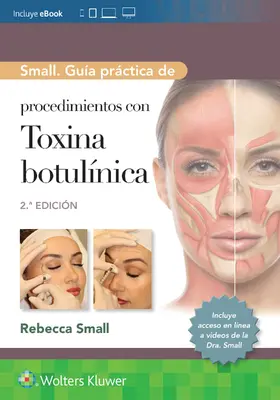 Small | Small. Guía práctica de procedimientos con toxina botulínica | Buch | 978-84-10022-27-0 | www.sack.de