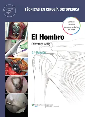 Craig | El hombro | Buch | 978-84-15684-07-7 | sack.de