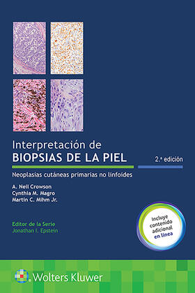 Crowson / Magro / Mihm | Interpretacion De Biopsias De La Piel. Neoplasias Cutáneas Primarias No Linfoides | Buch | 978-84-17602-82-6 | sack.de