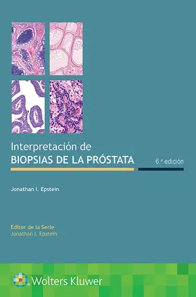 Epstein |  Interpretación de biopsias de la próstata | Buch |  Sack Fachmedien