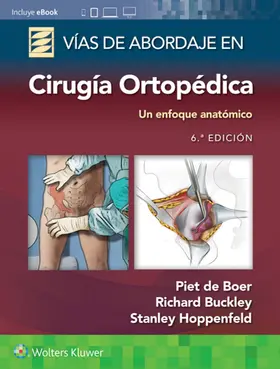 de Boer / Buckley / Hoppenfeld |  Vías de abordaje de cirugía ortopédica. Un enfoque anatómico | Buch |  Sack Fachmedien