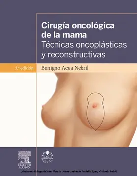 Cirugía oncológica de la mama + acceso web | E-Book | www.sack.de