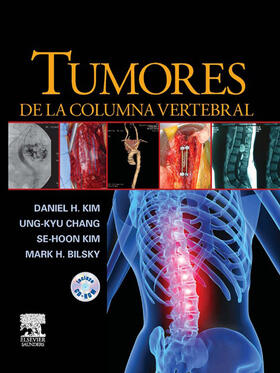 Kim / Chang | Tumores de la columna vertebral | E-Book | sack.de