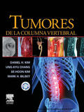 Kim / Chang |  Tumores de la columna vertebral | eBook | Sack Fachmedien