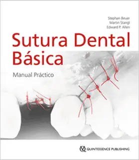 Beuer / Stangl / Allen |  Sutura Dental Básica | Buch |  Sack Fachmedien