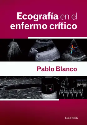 Blanco |  Ecografía en el enfermo crítico + acceso web | eBook | Sack Fachmedien