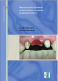 Mallat Callís / Eee Labor Dental |  Reconstrucción de dientes endodonciados | eBook | Sack Fachmedien