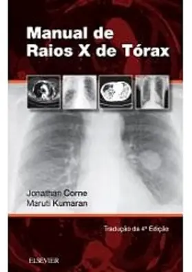 Corne / Kumaran |  Manual de Raios-X de Tórax | eBook | Sack Fachmedien