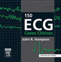 Hampton |  150 ECG Casos Clinicos | eBook | Sack Fachmedien