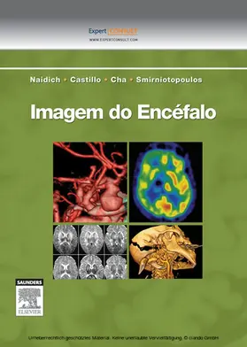 Castillo / Cha |  Imagem do Encéfalo | eBook | Sack Fachmedien