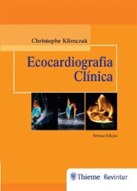 Klimczak |  Ecocardiografia Clínica | eBook | Sack Fachmedien