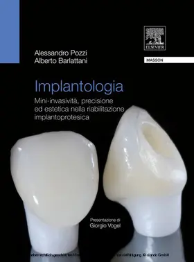 Pozzi / Barlattani |  Implantologia | eBook | Sack Fachmedien