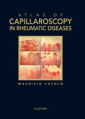 Cutolo |  Atlas of capillaroscopy in rheumatic diseases | eBook | Sack Fachmedien
