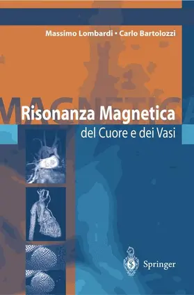 Lombardi / Bartolozzi |  Risonanza Magnetica del Cuore E Dei Vasi | Buch |  Sack Fachmedien