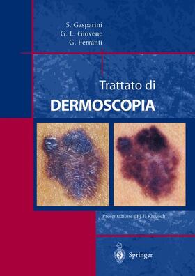 Gasparini / Giovene / Ferranti |  Trattato Di Dermoscopia | Buch |  Sack Fachmedien
